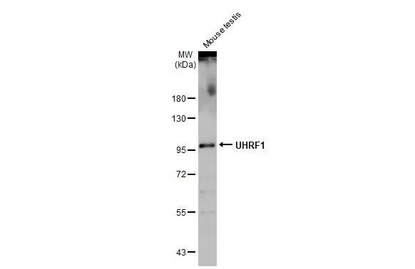 Western Blot: UHRF1 Antibody [NBP2-20807] - Mouse tissue extract (50 ug) was separated by 7.5% SDS-PAGE, and the membrane was blotted with UHRF1 antibody (NBP2-20807) diluted at 1:1000. The HRP-conjugated anti-rabbit IgG antibody  was used to detect the primary antibody.