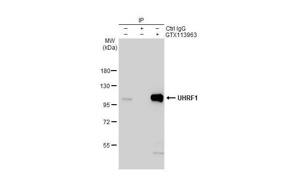 Immunoprecipitation of UHRF1 protein from HeLa whole cell extract using 5 ug of UHRF1 antibody (NBP2-20807).Western blot analysis was performed using UHRF1 antibody (NBP2-20807).EasyBlot HRP-conjugated anti rabbit IgG antibody . 
