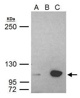 UHRF1 antibody immunoprecipitates UHRF1 protein in IP experiments. IP Sample: HeLa whole cell lysate/extract A. 40 ug HeLa whole cell lysate/extract B. Control with 2 ug of preimmune rabbit IgG C. Immunoprecipitation of UHRF1 protein by 2 ug of UHRF1 antibody (NBP2-20807) 5% SDS-PAGE The immunoprecipitated UHRF1 protein was detected by UHRF1 antibody (NBP2-20807) diluted at 1:1000. EasyBlot anti-rabbit IgG  was used as a secondary reagent. 