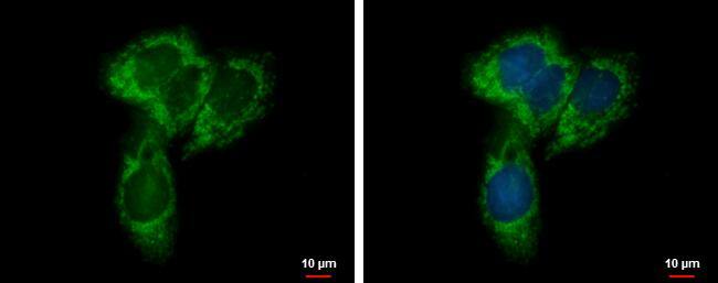 <b>Genetic Strategies Validation. </b>NYREN18 antibody [N1N3] detects NYREN18 protein at mitochondria by immunofluorescent analysis.Sample: HepG2 cells were fixed in 2% paraformaldehyde/culture medium at 37C for 30 min.Green: NYREN18 protein stained by NYREN18 antibody [N1N3] (NBP2-20815) diluted at 1:500.Blue: Hoechst 33342 staining. 