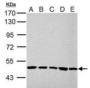 UQCRC1 antibody detects UQCRC1 protein by western blot analysis.A. 30 ug 293T whole cell lysate/extractB. 30 ug A431 whole cell lysate/extract C. 30 ug HeLa whole cell lysate/extractD. 30 ug HepG2 whole cell lysate/extract E. 30 ug A375 whole cell lysate/extract10% SDS-PAGEUQCRC1 antibody (NBP2-20815) dilution: 1:10000 The HRP-conjugated anti-rabbit IgG antibody  was used to detect the primary antibody. 