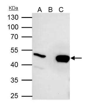 UQCRC2 antibody immunoprecipitates UQCRC2 protein in IP experiments.IP samples: HepG2 whole cell extractA. 35 ug HepG2 whole cell extractB. Control with 4 ug of preimmune Rabbit IgGC. Immunoprecipitation of UQCRC2 protein by 4 ug UQCRC2 antibody (NBP2-20816)10 % SDS-PAGEThe immunoprecipitated UQCRC2 protein was detected by UQCRC2 antibody (NBP2-20816) diluted at 1:5000.[EasyBlot anti-rabbit IgG  was used as a secondary reagent] 