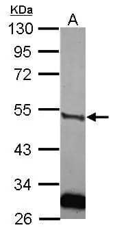 Sample (30 ug of whole cell lysate)  A: IMR32  10% SDS PAGE  NBP2-20819 diluted at 1:2000  