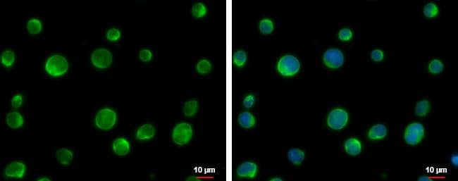 URP2 antibody detects URP2 protein at cytoplasm by immunofluorescent analysis.Sample: Jurkat cells were fixed in 4% paraformaldehyde at RT for 15 min.Green: URP2 protein stained by URP2 antibody (NBP2-20821) diluted at 1:500.Blue: Hoechst 33342 staining.Scale bar = 10 um. 