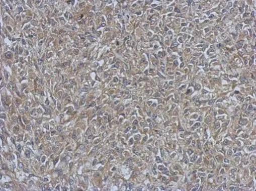 Immunohistochemical analysis of paraffin-embedded RT2 xenograft, using URP2(NBP2-20821) antibody at 1:500 dilution. br>Antigen Retrieval: Trilogy(TM) (EDTA based, pH 8.0) buffer, 15min 