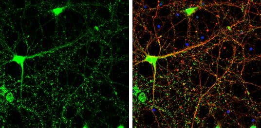USP14 antibody detects USP14 protein by immunofluorescent analysis.Sample: DIV14 rat E18 primary cortical neurons were fixed in 4% paraformaldehyde at RT for 15 min.Green: USP14 protein stained by USP14 antibody (NBP2-20826) diluted at 1:500.Red: beta Tubulin 3/ Tuj1, stained by beta Tubulin 3/ Tuj1 antibody [GT1338]  diluted at 1:500.Blue: Fluoroshield with DAPI . 