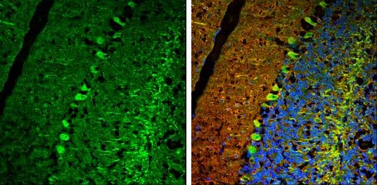 USP14 antibody detects USP14 protein expression by immunohistochemical analysis.Sample: Frozen-sectioned adult mouse cerebellum. Green: USP14 protein stained by USP14 antibody (NBP2-20826) diluted at 1:250.Red: beta Tubulin 3/ TUJ1, stained by beta Tubulin 3/ Tuj1 antibody [GT886]  diluted at 1:500.Blue: Fluoroshield with DAPI . 