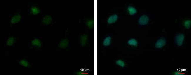Immunocytochemistry/ Immunofluorescence USP26 Antibody - BSA Free