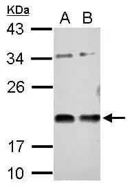 Western Blot: Vasohibin Antibody [NBP2-20845] - Sample (30 ug of whole cell lysate)  A: A431   B: HepG2   12% SDS PAGE  NBP2-20845 diluted at 1:1000 