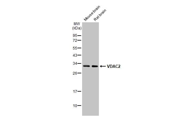 Western Blot: VDAC2 Antibody [NBP2-20849] - Various tissue extracts (50 ug) were separated by 12% SDS-PAGE, and the membrane was blotted with VDAC2 antibody [C2C3], C-term (NBP2-20849) diluted at 1:1000. The HRP-conjugated anti-rabbit IgG antibody  was used to detect the primary antibody.