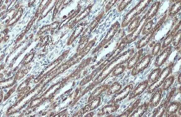 Immunohistochemistry-Paraffin VDAC2 Antibody - BSA Free
