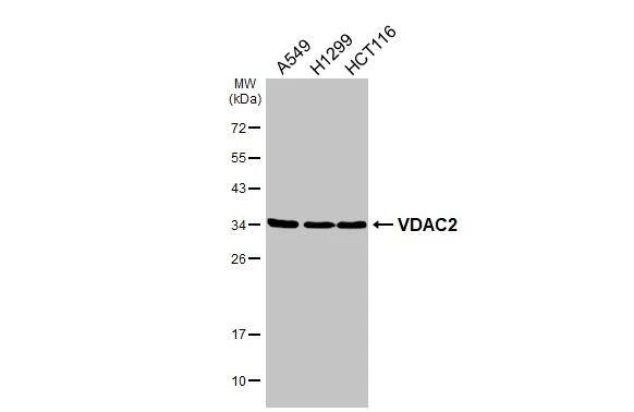 Western Blot VDAC2 Antibody - BSA Free