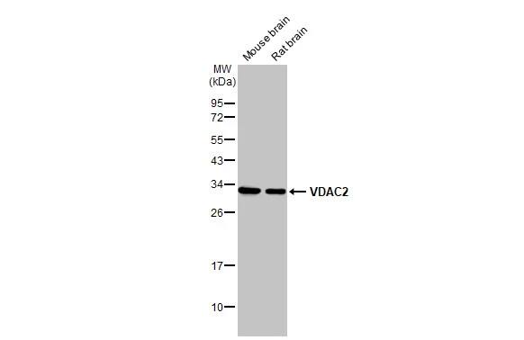 Western Blot: VDAC2 Antibody [NBP2-20850] - Various tissue extracts (50 ug) were separated by 12% SDS-PAGE, and the membrane was blotted with VDAC2 antibody [N1C2] (NBP2-20850) diluted at 1:1000. The HRP-conjugated anti-rabbit IgG antibody  was used to detect the primary antibody.