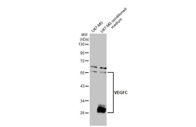 Western Blot: VEGF-C Antibody [NBP2-20853] - U87-MG whole cell extract and conditioned medium (30 ug) were separated by 10% SDS-PAGE, and the membrane was blotted with VEGF-C antibody (NBP2-20853) diluted at 1:500. The HRP-conjugated anti-rabbit IgG antibody  was used to detect the primary antibody.