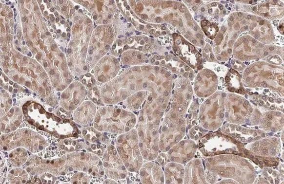 Immunohistochemistry-Paraffin VEGF-C Antibody - BSA Free