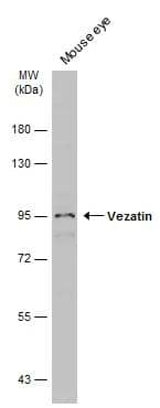 Mouse tissue extract (50 ug) was separated by 7.5% SDS-PAGE, and the membrane was blotted with Vezatin antibody (NBP2-20855) diluted at 1:3000. The HRP-conjugated anti-rabbit IgG antibody  was used to detect the primary antibody. 