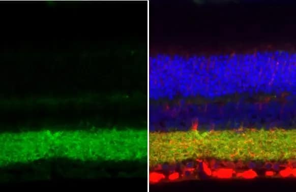 Immunohistochemistry-Paraffin: VIAAT/SLC32A1/VGAT Antibody [NBP2-20857] - VIAAT/SLC32A1/VGAT antibody [N1N2], N-term detects VIAAT/SLC32A1/VGAT protein at cytoplasm by immunohistochemical analysis.Sample: Paraffin-embedded mouse eye.Green: VIAAT/SLC32A1/VGAT stained by VIAAT/SLC32A1/VGAT antibody [N1N2], N-term (NBP2-20857) diluted at 1:500.Red: beta Tubulin 3/ Tuj1, a neural marker, stained by beta Tubulin 3/ Tuj1 antibody [GT11710]  diluted at 1:500.Blue: Fluoroshield with DAPI .Antigen Retrieval: Citrate buffer, pH 6.0, 15 min