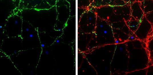 VGAT antibody [N1N2], N-term detects VGAT protein expression by immunofluorescent analysis.Sample: Cultured rat E18 primary cortical neuron, DIV 8. Cells were fixed in 4% paraformaldehyde at RT for 15 min.Green: VGAT protein stained by VGAT antibody [N1N2], N-term (NBP2-20857) diluted at 1:250.Red: beta Tubulin 3/ TUJ1, stained by beta Tubulin 3/ TUJ1 antibody [GT11710]  diluted at 1:250.Blue: Fluoroshield with DAPI . 