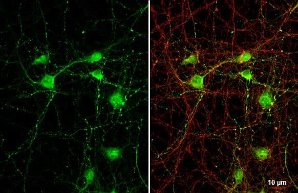 VGAT antibody [N1N2], N-term detects VGAT protein by immunofluorescent analysis. Sample: DIV9 rat cortical neuron and Glia cells were fixed in 4% paraformaldehyde at RT for 15 min. Green: VGAT stained by VGAT antibody [N1N2], N-term (NBP2-20857) diluted at 1:250. Red: Tau, an axon marker, stained by Tau antibody [GT287]  diluted at 1:500. 