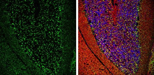VGAT antibody [N1N2], N-term detects VGAT protein expression by immunohistochemical analysis.Sample: Frozen-sectioned adult mouse cerebellum. Green: VGAT protein stained by VGAT antibody [N1N2], N-term (NBP2-20857) diluted at 1:250.Red: beta Tubulin 3/ TUJ1, stained by beta Tubulin 3/ TUJ1 antibody [GT11710]  diluted at 1:500.Blue: Fluoroshield with DAPI . 