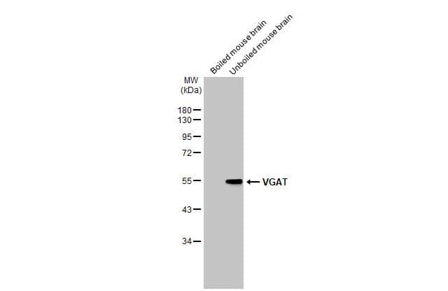 Boiled and unboiled various tissue extracts (50 ug) were separated by 10% SDS-PAGE, and the membrane was blotted with VGAT antibody [N1N2], N-term (NBP2-20857) diluted at 1:3000. The HRP-conjugated anti-rabbit IgG antibody  was used to detect the primary antibody. 