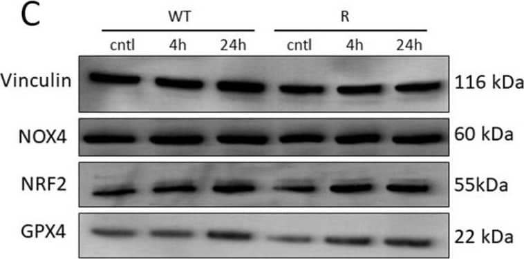 Effects of erastin (2.5 uM) on various oxidative and ferroptosis-related genes in OVCAR-8 (A) and NCI/ADR-RES cells (B) cells following treatment with erastin for 4 h and 24 h. Protein levels for GPX4, NrF2, and NOX4 following treatment with 2.5 uM for 4 and 24 h in OVCAR-8 and NCI/ADR-RES cells (C). * p < 0.05, ** and *** p values < 0.005 and 0.001, respectively, compared to control ( beta -Actin at 4 h and 24 h, respectively). Image collected and cropped by CiteAb from the following open publication (//www.mdpi.com/1422-0067/25/16/8666), licensed under a CC-BY license. Not internally tested by Novus Biologicals.