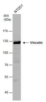 Vinculin antibody detects Vinculin protein by western blot analysis. Whole cell extracts (30 ug) was separated by 7.5% SDS-PAGE, and the membrane was blotted with Vinculin antibody (NBP2-20859) diluted at 1:1000. The HRP-conjugated anti-rabbit IgG antibody  was used to detect the primary antibody. 