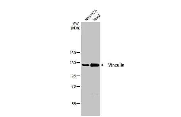 Various whole cell extracts (50 ug) were separated by 7.5% SDS-PAGE, and the membrane was blotted with Vinculin antibody [N1N3] (NBP2-20859) diluted at 1:1000. The HRP-conjugated anti-rabbit IgG antibody  was used to detect the primary antibody. 
