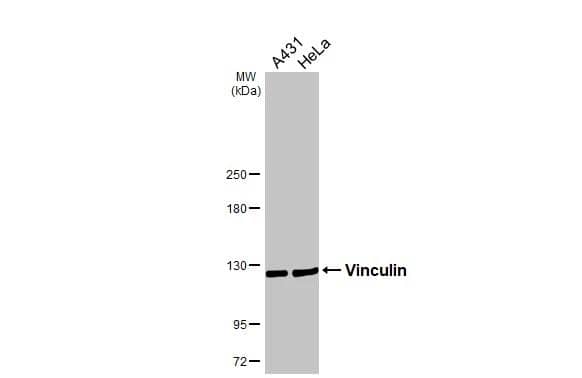Various whole cell extracts (30 ug) were separated by 5% SDS-PAGE, and the membrane was blotted with Vinculin antibody [N1N3] (NBP2-20859) diluted at 1:10000. The HRP-conjugated anti-rabbit IgG antibody  was used to detect the primary antibody. 