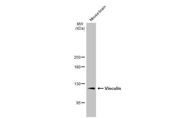 Mouse tissue extract (50 ug) was separated by 5% SDS-PAGE, and the membrane was blotted with Vinculin antibody [N1N3] (NBP2-20859) diluted at 1:1000. The HRP-conjugated anti-rabbit IgG antibody  was used to detect the primary antibody. 