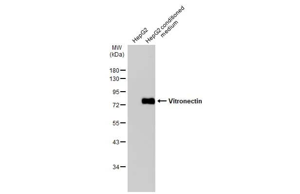 Western Blot: Vitronectin Antibody [NBP2-20866] - HepG2 whole cell extract and conditioned medium (30 ug) were separated by 10% SDS-PAGE, and the membrane was blotted with Vitronectin antibody (NBP2-20866) diluted at 1:1000. The HRP-conjugated anti-rabbit IgG antibody  was used to detect the primary antibody.