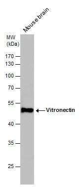 Vitronectin antibody detects Vitronectin protein by western blot analysis. Mouse tissue extracts (50 ug) was separated by 10% SDS-PAGE, and the membrane was blotted with Vitronectin antibody (NBP2-20866) diluted by 1:1000. The HRP-conjugated anti-rabbit IgG antibody  was used to detect the primary antibody. 