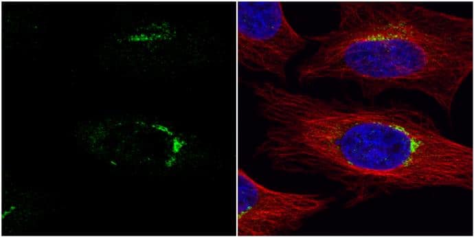 Western Blot: VPS33A Antibody [NBP2-20872] - VPS33A was the direct target of miR-423-5p. (A) The location of the two miR-423-5p binding domains. Interaction domains are indicated by red font. Mutant sequences are indicated by bold font. (B) The structure diagram of the constructed plasmids. (C) A 2 × 4 (factor of miRNA: NC mimic & miR-423-5p mimic, 100 nM; factor of luciferase reporter plasmid: pmirGLO vector (mock), pmirGLO-WT, pmirGLO-MT1, pmirGLO-MT2 & pmirGLO-MT (1 + 2)) orthogonal experiment for Dual-Glo-Luciferase-Assay was performed. (D) The co-localization of LC3-GFP puncta with lysosomes in the macrophages transfected with VPS33A specific siRNA (negative siRNA as NC) was analyzed. More than 20 cells from three independent experiments were analyzed. Scale bars: 5 μm. (E) The expression levels of VPS33A in the macrophages transfected with VPS33A specific siRNA or NC siRNA were analyzed. (F) The co-localization of LC3-GFP puncta with lysosomes in the macrophages transfected with NC mimic, miR-423-5p mimic, or miR-423-5p mimic + pcDNA-VPS33A were analyzed. More than 20 cells from three independent experiments were analyzed. Scale bars: 5 μm. (G) The protein levels of VPS33A in the macrophages transfected with NC mimic, miR-423-5p mimic, or miR-423-5p mimic + pcDNA-VPS33A were analyzed by western blot. The statistical results were obtained from more than three independent experiments. Target genes were normalized with  beta -actin. Data are presented as mean ± SD, & Error bars indicate the SD. NC: negative control. *P Sample: HeLa cells were fixed in 4% paraformaldehyde at RT for 15 min.Green: VPS33A protein stained by VPS33A antibody [C1C3] (NBP2-20872) diluted at 1:200.Red: alpha Tubulin, a cytoskeleton marker, stained by alpha Tubulin antibody [GT114]  diluted at 1:1000.Blue: Hoechst 33342 staining. 
