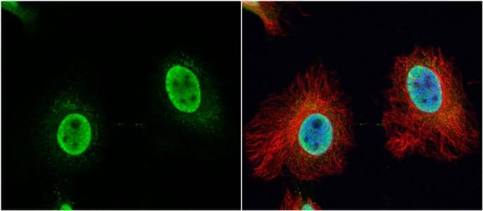 Immunocytochemistry/ Immunofluorescence VPS4B Antibody - BSA Free