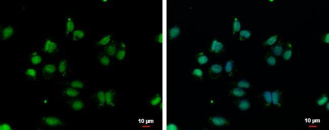 Immunocytochemistry/ Immunofluorescence VPS4B Antibody - BSA Free