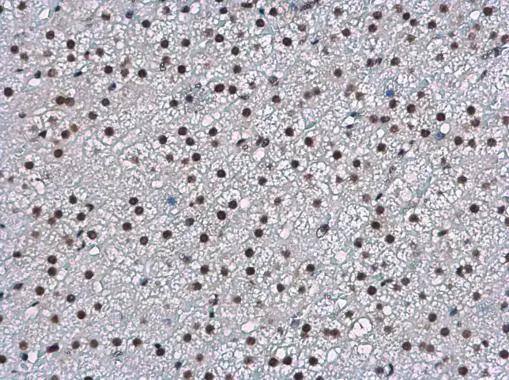 WBP11 antibody detects WBP11 protein at nucleus in rat adrenal by immunohistochemical analysis. Sample: Paraffin-embedded rat adrenal. WBP11 antibody (NBP2-20886) diluted at 1:500. br>Antigen Retrieval: Citrate buffer, pH 6.0, 15 min 