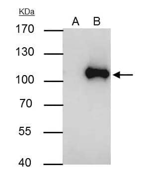 WBP11 antibody immunoprecipitates WBP11 protein in IP experiments.IP samples: Jurkat whole cell extractA. Control with 4 ug of preimmune Rabbit IgGB. Immunoprecipitation of WBP11 protein by 4 ug WBP11 antibody (NBP2-20886)7.5 % SDS-PAGEThe immunoprecipitated WBP11 protein was detected by WBP11 antibody (NBP2-20886) diluted at 1:1000.[EasyBlot anti-rabbit IgG  was used as a secondary reagent] 