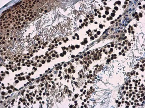 Immunohistochemistry-Paraffin WDR62 Antibody