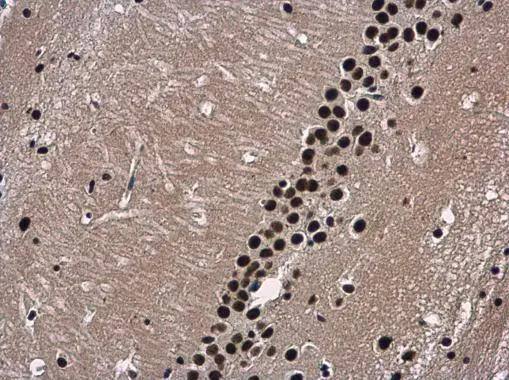 Wdr62 antibody detects Wdr62 protein at nucleus in mouse brain by immunohistochemical analysis. Sample: Paraffin-embedded mouse brain. Wdr62 antibody (NBP2-20897) diluted at 1:500. br>Antigen Retrieval: Citrate buffer, pH 6.0, 15 min 