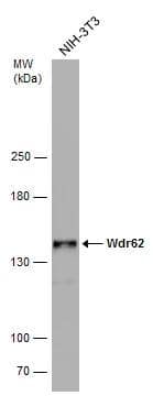 Western Blot WDR62 Antibody
