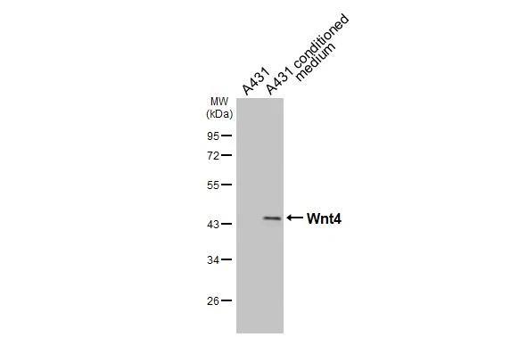 A431 whole cell extract and conditioned medium (30 ug) were separated by 10% SDS-PAGE, and the membrane was blotted with Wnt4 antibody (NBP2-20909) diluted at 1:1000. The HRP-conjugated anti-rabbit IgG antibody  was used to detect the primary antibody. 