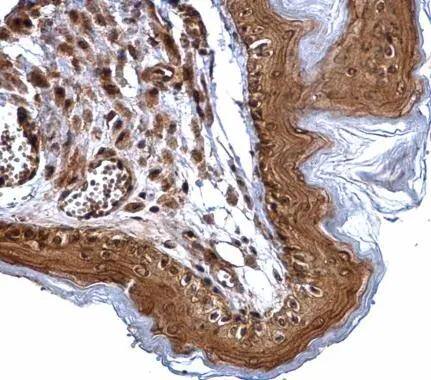 ERCC2 antibody [N2C2], Internal detects ERCC2 protein at cytosol and nucleus on mouse esophagus by immunohistochemical analysis. Sample: Paraffin-embedded mouse esophagus. ERCC2 antibody [N2C2], Internal (NBP2-20923) dilution: 1:500. Antigen Retrieval: Trilogy(TM) (EDTA based, pH 8.0) buffer, 15min 