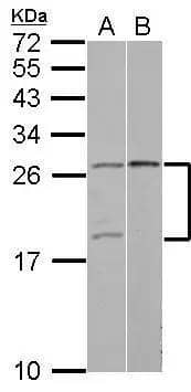 Sample (30 ug of whole cell lysate)  A: 293T  B: Raji  15% SDS PAGE  NBP2-20927 diluted at 1:500  