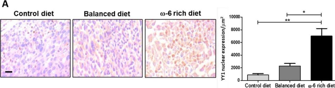 High intake of  omega -6 PUFA induces the expression of aggressiveness markers. (A) Representative photomicrographs and analysis of YY1 expression (* p < 0.05 and ** p < 0.01). (B) COX-2 immunostaining, * p < 0.05. (C) TGF-beta  immunostaining (* p < 0.05) in the groups of mice fed with control diet, balanced diet, and diet rich in  omega -6. Representative microphotographs of the expression of the different markers are shown on the left. On the right side, the quantification of the stains can be seen, the data represent the mean + SEM, n = 5. Scale bar: 20 um. (D) Analysis of YY1, (E) COX-2, and (F) VEGF-A mRNA in the groups of mice fed a balanced diet and a diet rich in  omega -6. Data represent mean + SEM, n = 5, * p < 0.05, ** p < 0.001. Results of three independent experiments are shown. Image collected and cropped by CiteAb from the following open publication (//pubmed.ncbi.nlm.nih.gov/35682855), licensed under a CC-BY license. Not internally tested by Novus Biologicals.