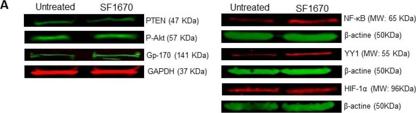 Inhibition of PTEN with SF1670 promotes the expression of NF-kappa B, YY1, and Gp-170. (A) Western Blot representative of the amount of total protein in RS4;11 cells treated with SF1670; the results show differences in the expression of p-Akt and Gp-170 (** p < 0.01; *** p < 0.001), after treatment with the inhibitor of PTEN. (B) The expression of NF-kappa B and YY1 in the cell line used is modified after treatment with the inhibitor (* p < 0.05; ** p < 0.01); PTEN does not show changes in the level of protein expression when using the PTEN inhibitor, and HIF-1 alpha  has no significant changes. (C) Expression of mRNA of YY1 is increased in RS4;11 cells after SF1670 treatment (*** p = 0.001 treatment vs. untreated). Image collected and cropped by CiteAb from the following open publication (//pubmed.ncbi.nlm.nih.gov/39063014), licensed under a CC-BY license. Not internally tested by Novus Biologicals.