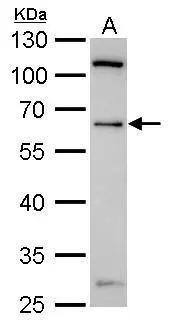 YY1 antibody detects YY1 protein by Western blot analysis.A. 30 ug 293T whole cell lysate/extract10 % SDS-PAGEYY1 antibody (NBP2-20933) dilution: 1:1000 