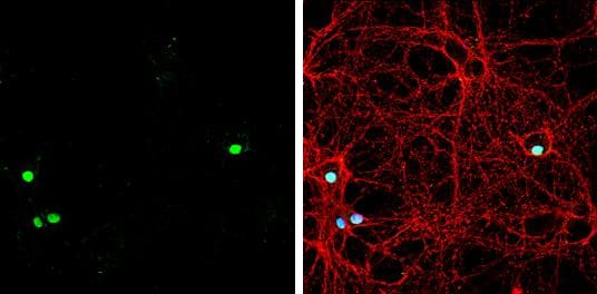 ZBTB20 antibody detects ZBTB20 protein at by immunofluorescent analysis.Sample: DIV9 rat E18 primary hippocampal neuron cells were fixed in 4% paraformaldehyde at RT for 15 min.Green: ZBTB20 stained by ZBTB20 antibody (NBP2-20936) diluted at 1:500.Red: beta Tubulin 3/ Tuj1, stained by beta Tubulin 3/ Tuj1 antibody [GT1338]  diluted at 1:500.Blue: Fluoroshield with DAPI . 