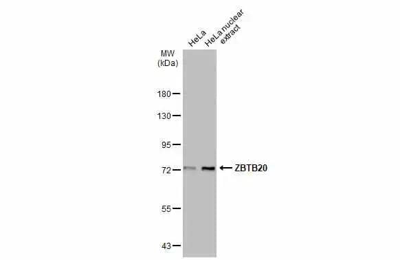 HeLa whole cell and nuclear extracts (30 ug) were separated by 7.5% SDS-PAGE, and the membrane was blotted with ZBTB20 antibody (NBP2-20936) diluted at 1:1000. The HRP-conjugated anti-rabbit IgG antibody  was used to detect the primary antibody. 