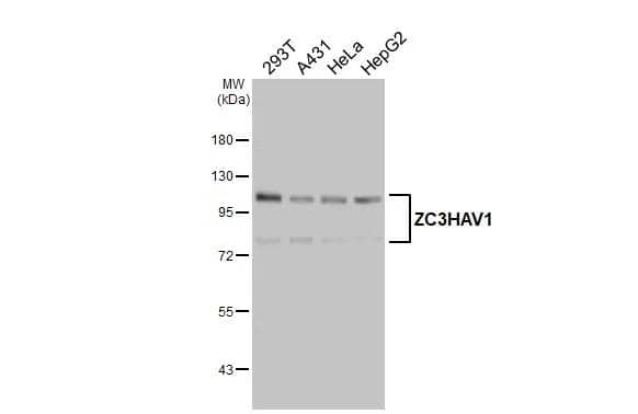 Western Blot ZCCHV Antibody - BSA Free