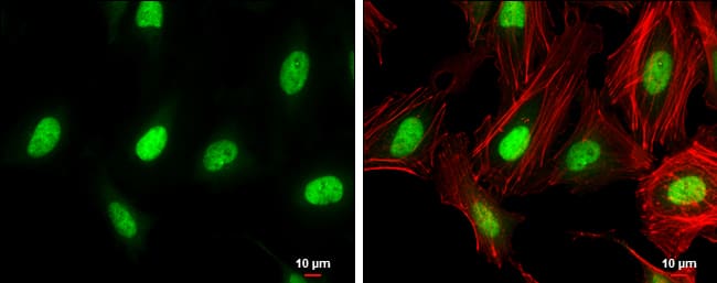 Immunocytochemistry/ Immunofluorescence: ZEB1 Antibody [NBP2-20942] - ZEB1 antibody [N2C1], Internal detects ZEB1 protein at nucleus by immunofluorescent analysis.Sample: HeLa cells were fixed in 4% paraformaldehyde at RT for 15 min.Green: ZEB1 protein stained by ZEB1 antibody [N2C1], Internal (NBP2-20942) diluted at 1:500.Red: Phalloidin, a cytoskeleton marker, diluted at 1:100.Scale bar = 10 um.